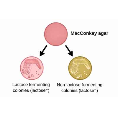 MacConkey آگار برای ارگانیسم های گرم منفی